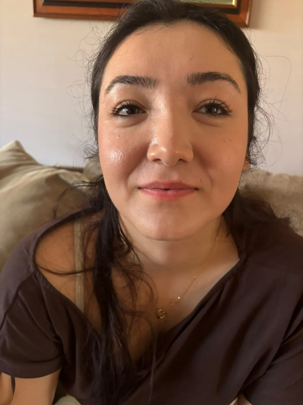 Before lip filler – Client smiling before lip filler treatment in Oakham, Rutland