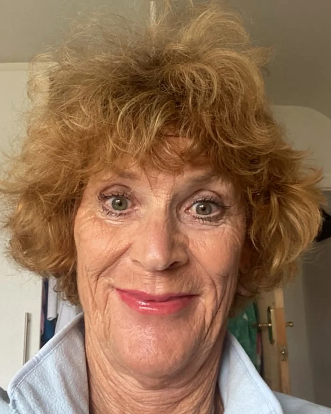 After anti-wrinkle injections – The same client after anti-wrinkle injections in Oakham, with a smoother, fresher look