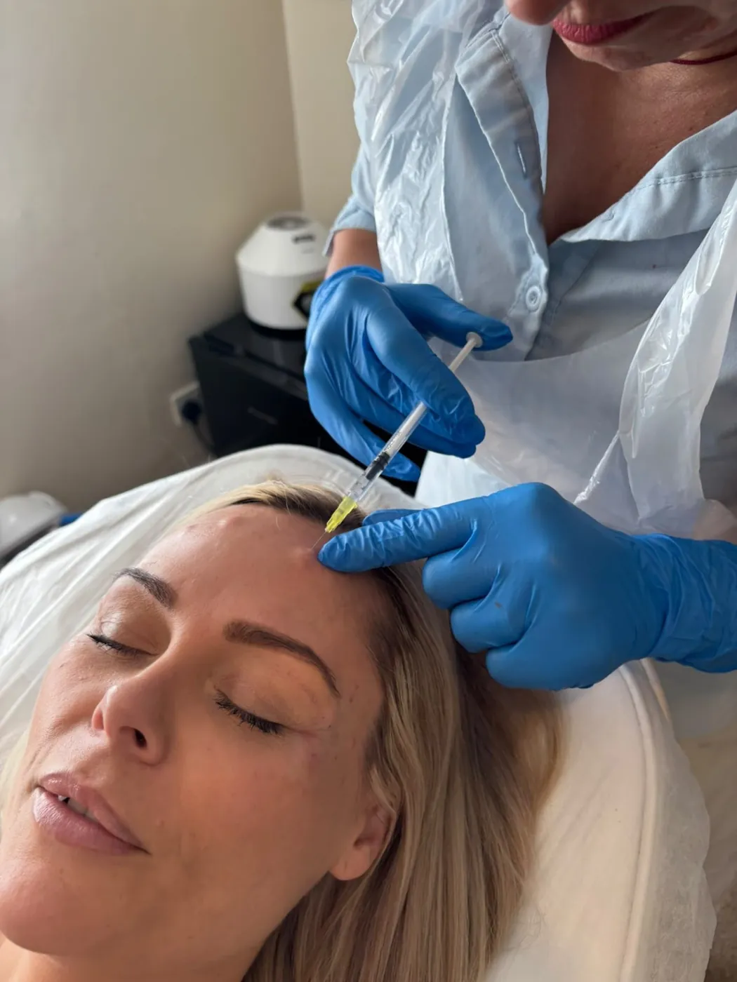 Mel Barge giving anti-wrinkle injections near the hairline in Oakham