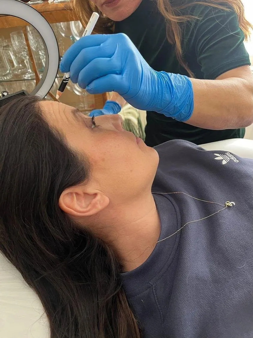 Dermal filler treatment with Mel Barge in Oakham