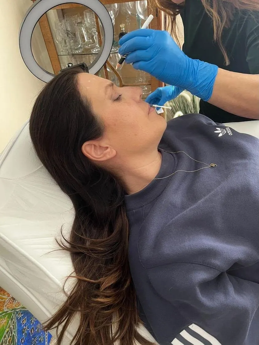Mel Barge marking the lip area before lip filler in Oakham