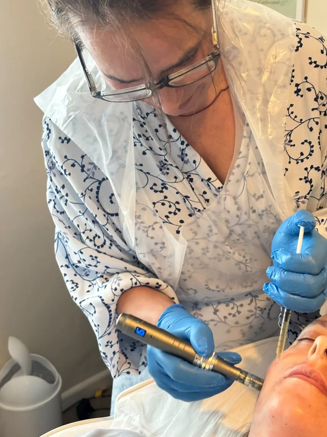 Mel Barge performing microneedling with a pen device in Oakham